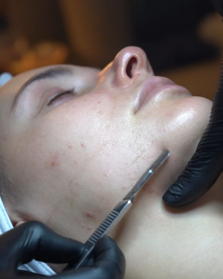 Dermaplane