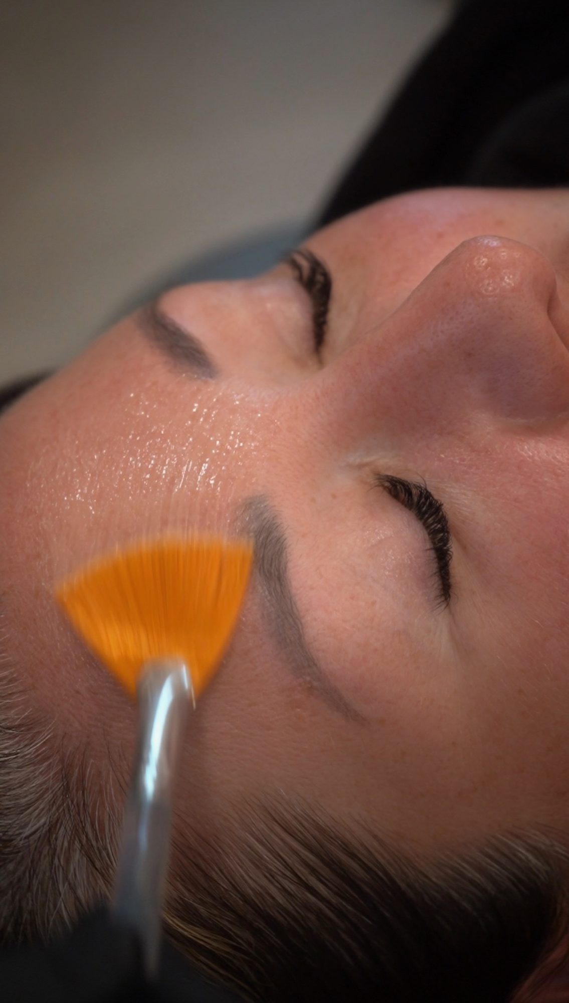 Oxygen Peel Facial